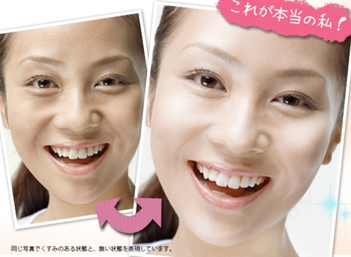 ��\�N�z�C�b�v�͌��ʂȂ��I�H